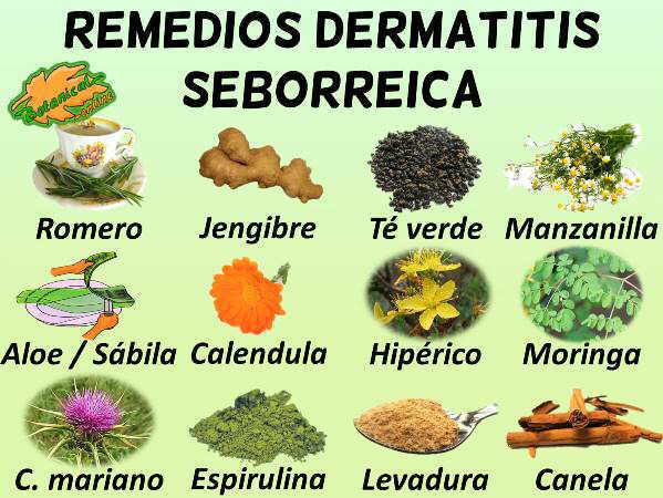 Remedios para la dermatitis seborreica – Botanical-online